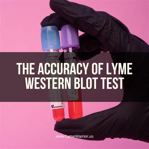 is lyme hard to test|is lyme disease accurate.